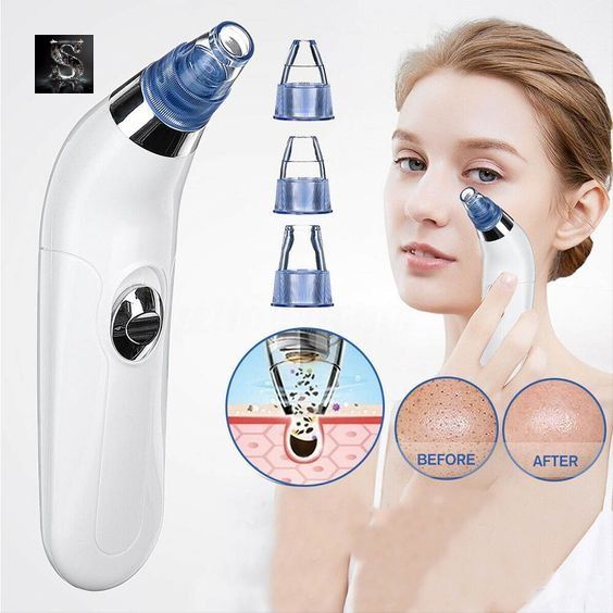 Electric Blackhead Remover Pore Cleaning Suction