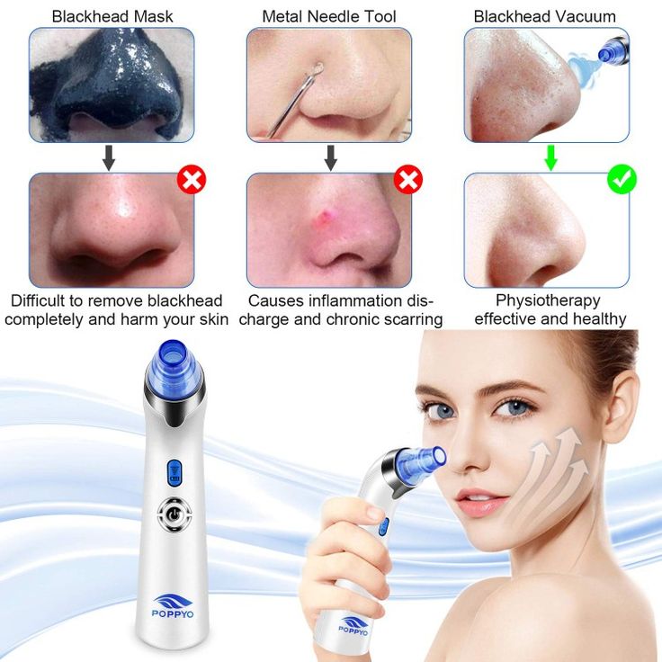 Electric Blackhead Remover Pore Cleaning Suction